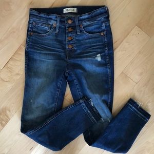 Madewell 10" High-Rise Skinny button Jeans, short